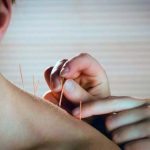 Agopuntura, Fitoterapia , Medicina Tradizionale Cinese